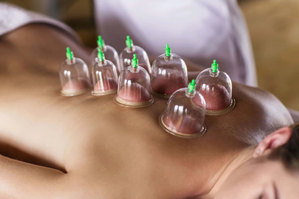 Cupping Session