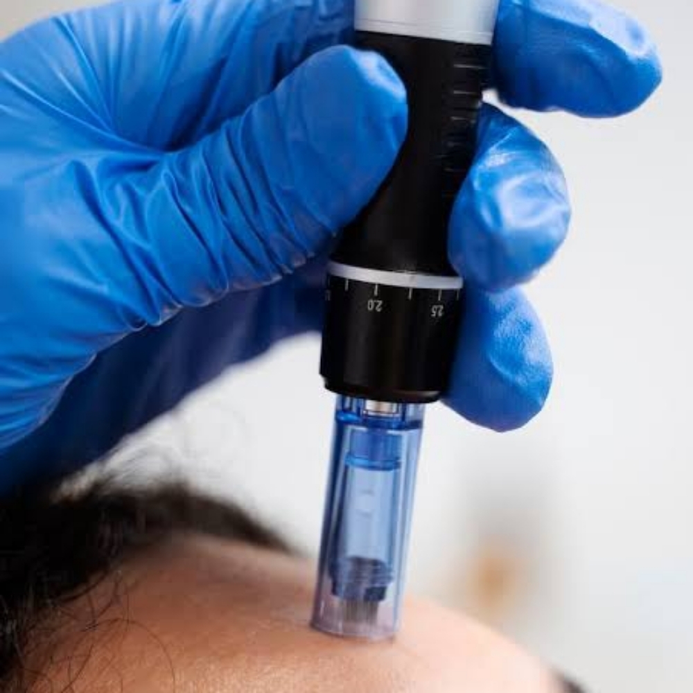 Microneedling at Rooted Rituals Esthetics Co. in North Ogden, UT