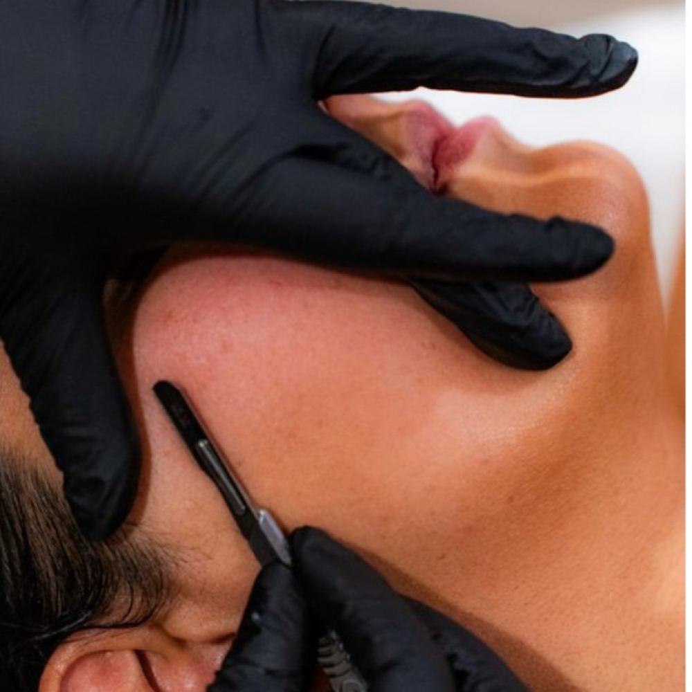 Dermaplane Add-On at European Head Spa & Aesthetics in Brentwood, TN