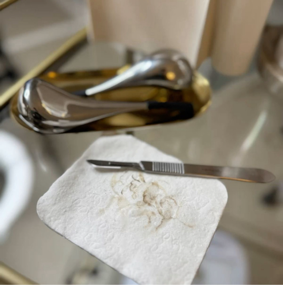 Add On Dermaplane at Serenity Aesthetics in Sarasota, FL