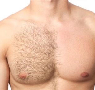Chest (Full)