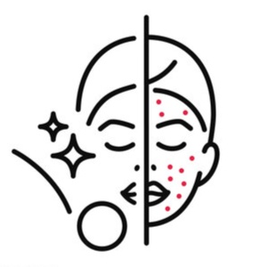 Clear Skin Facial Peel at Aimee's Esthetics in Cullman, AL
