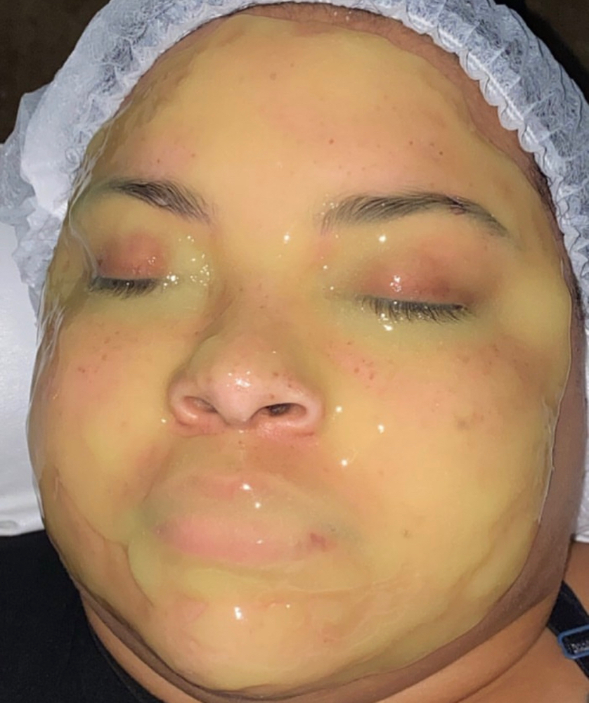 Hydrojelly Mask *add on to facials*