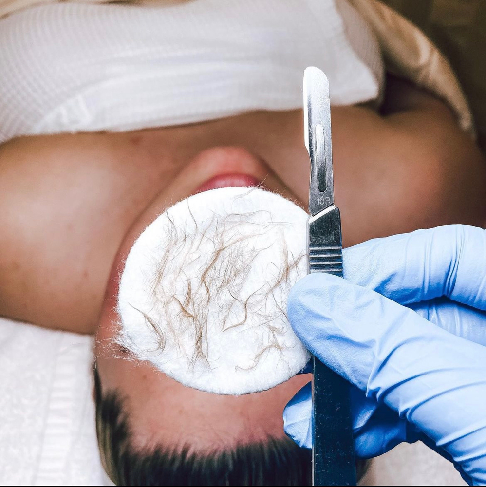 Dermaplaning at Glowbysarah in Bakersfield, CA