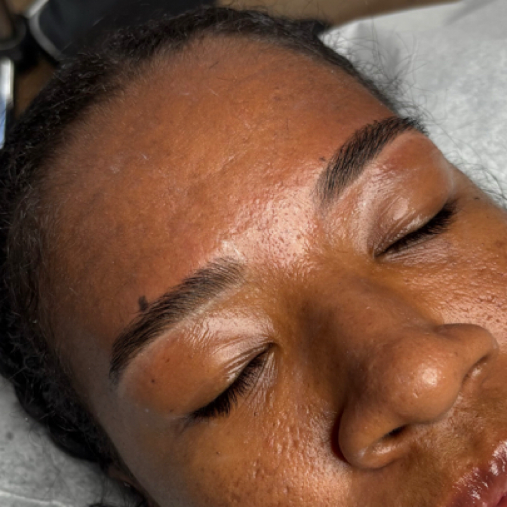 The Golden Brow Lift (Return) at Golden Vanity Aesthetics in Riverside, CA