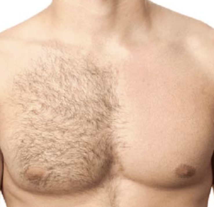 Chest Wax