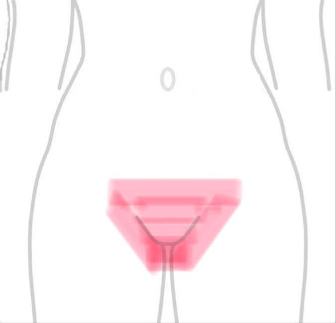 Brazilian Wax