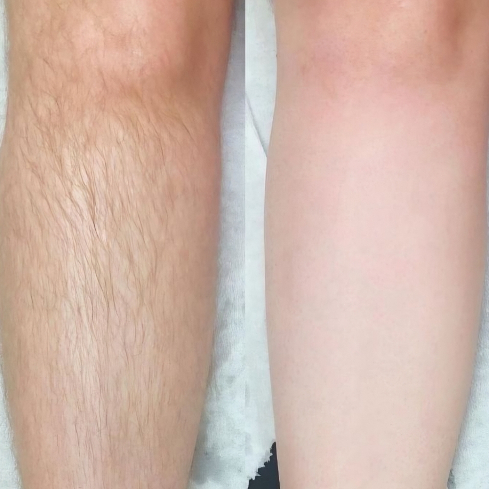 Lower Legs Wax at Entouch Day Spa  |   La Pine's Premier Facial Spa & Waxing Studio in La Pine, OR