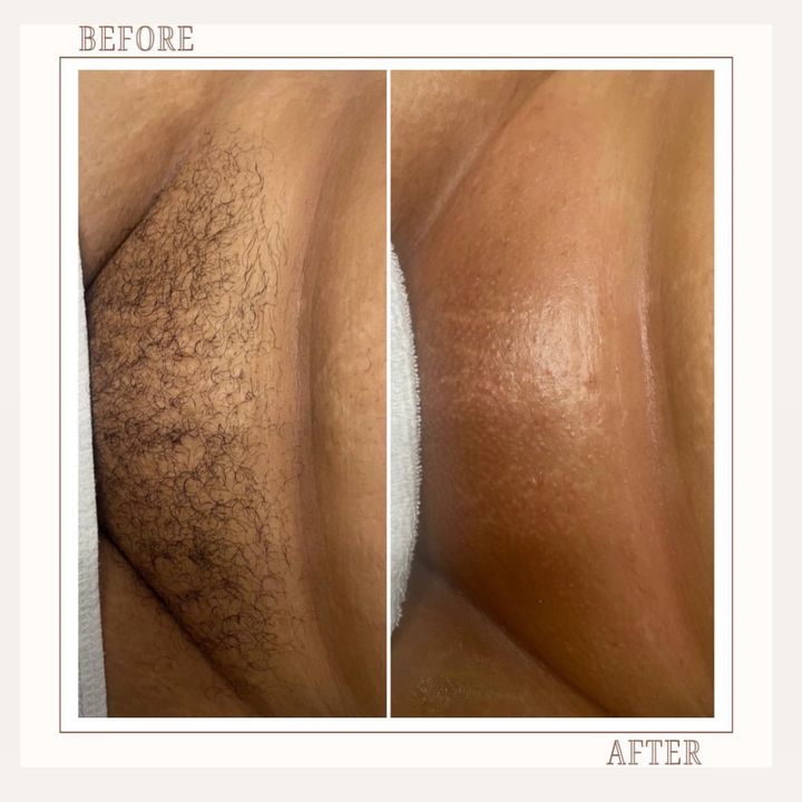 Brazilian Wax
