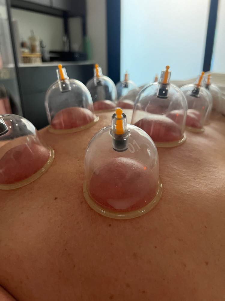 Cupping ADD ON