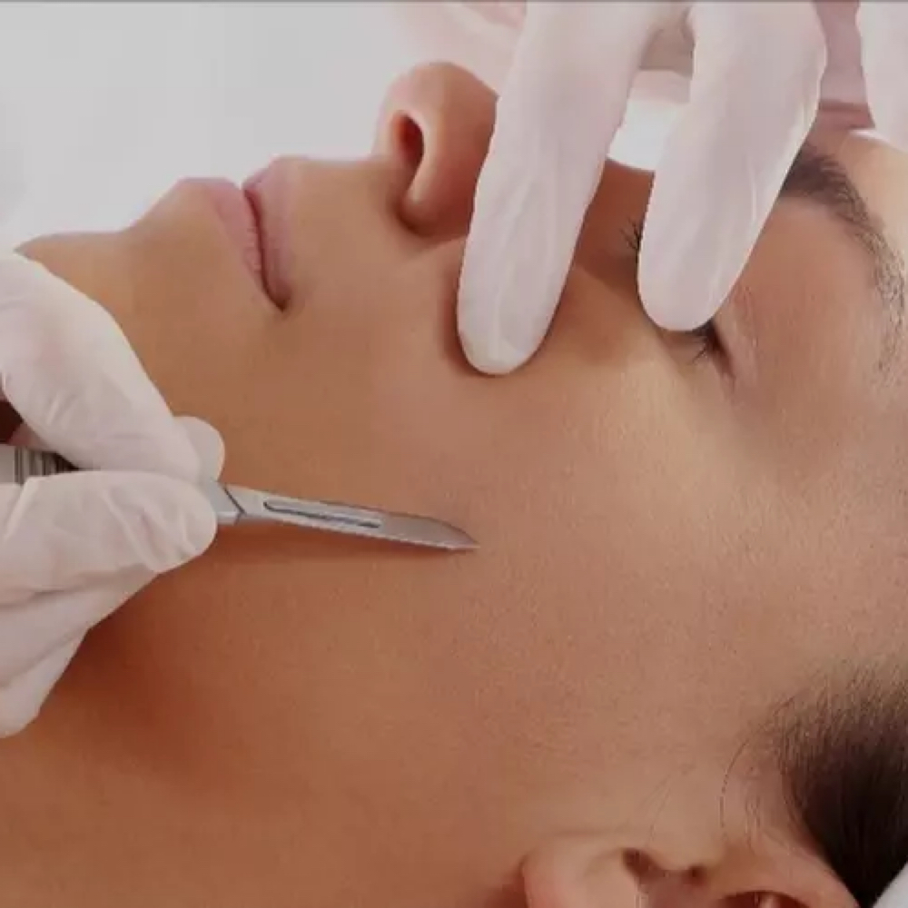 Dermaplanning Facial