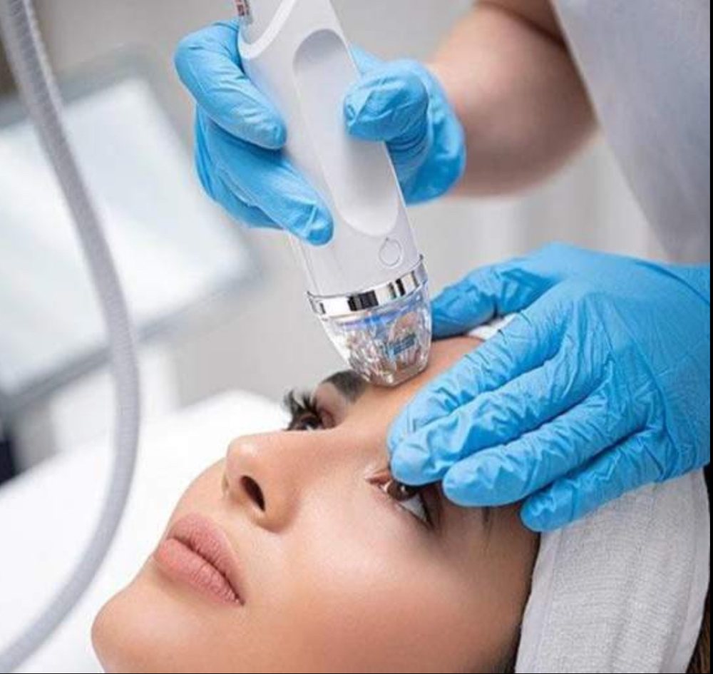 Robotic Micro Chaneedling With RF