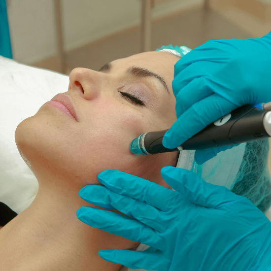 Microneedling Boca Raton at Boca Skin and Lash in Boca Raton, FL