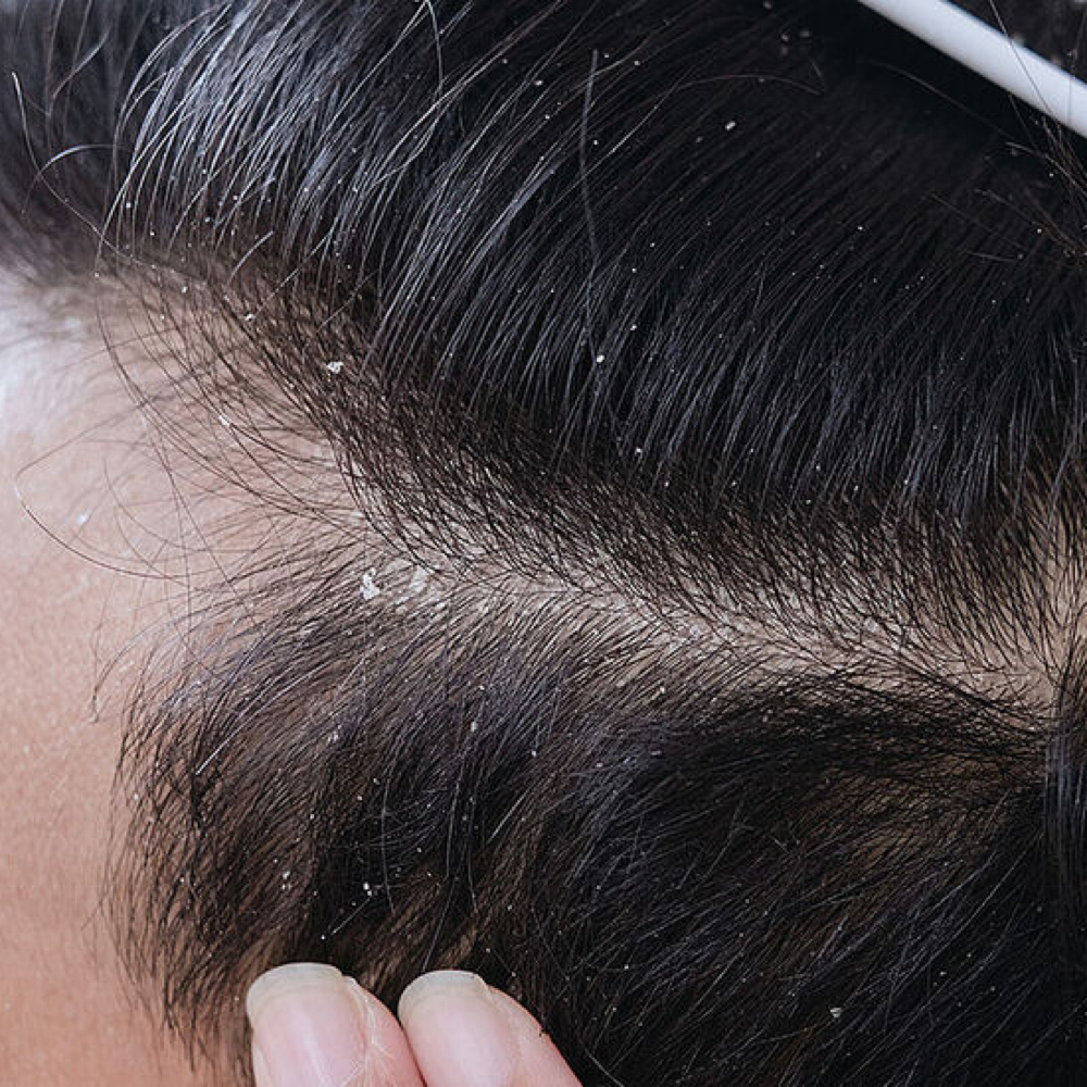 Scalp Therapy at Stylinlike.george in King City, CA