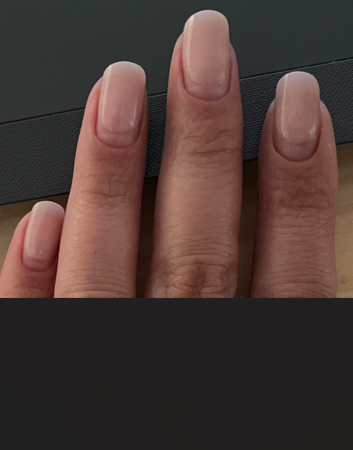 Structured Gel Fill-in