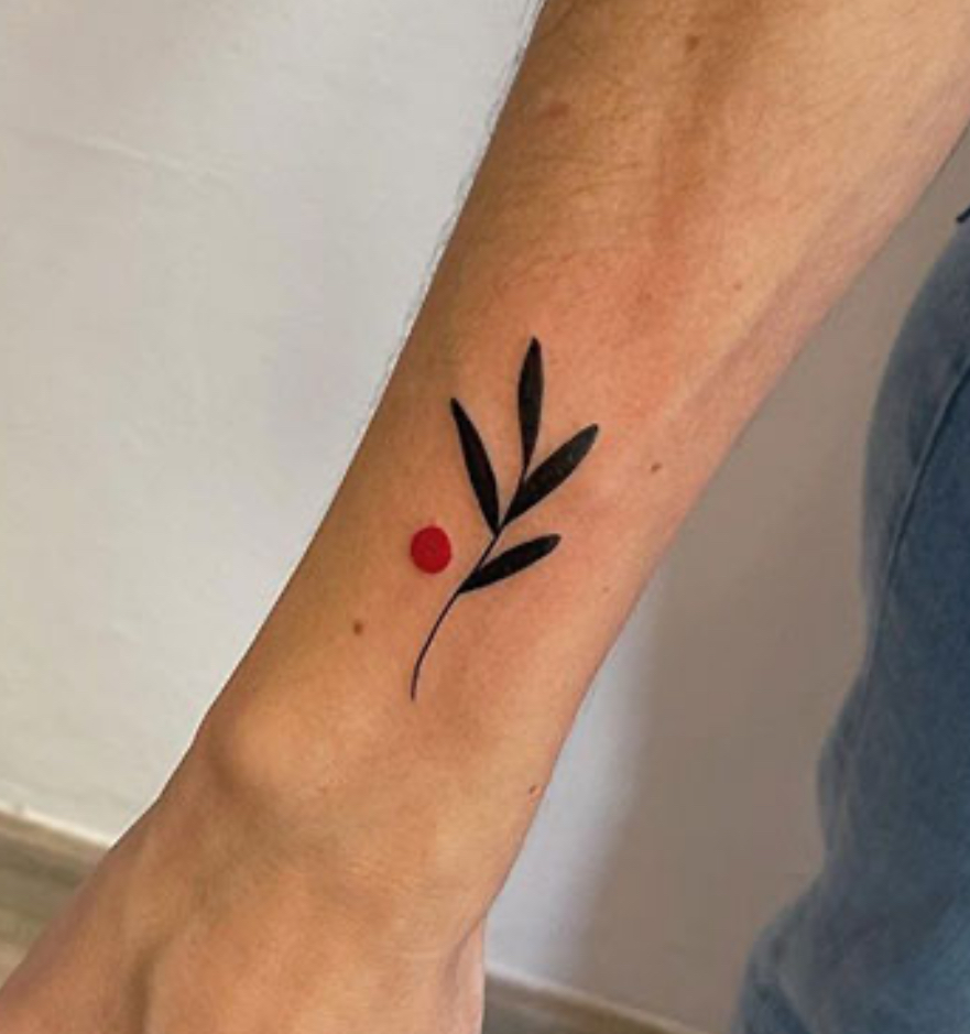 Tatto Removal / Eliminacion Tatuaje
