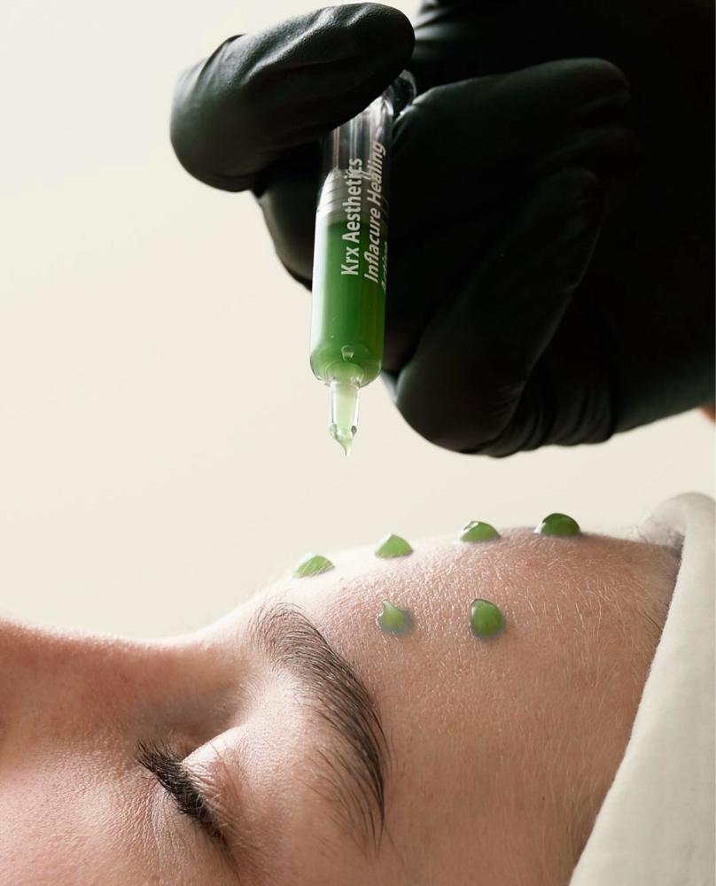 Skin Recovery Facial -Acne, Rosacea