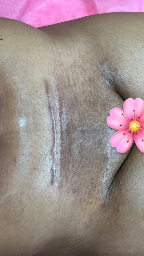 Brazilian Wax