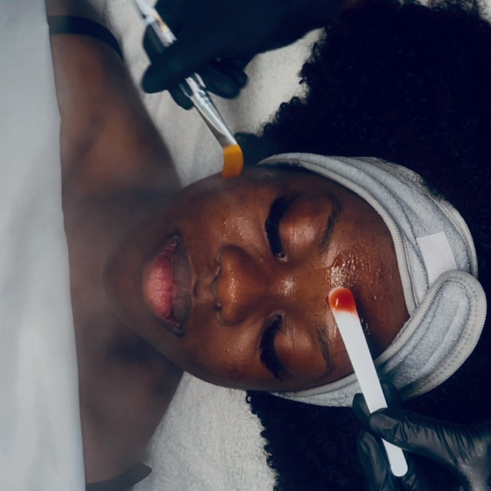 Enzyme Treatment at Refinery Aesthetics Loft in Oxon Hill, MD