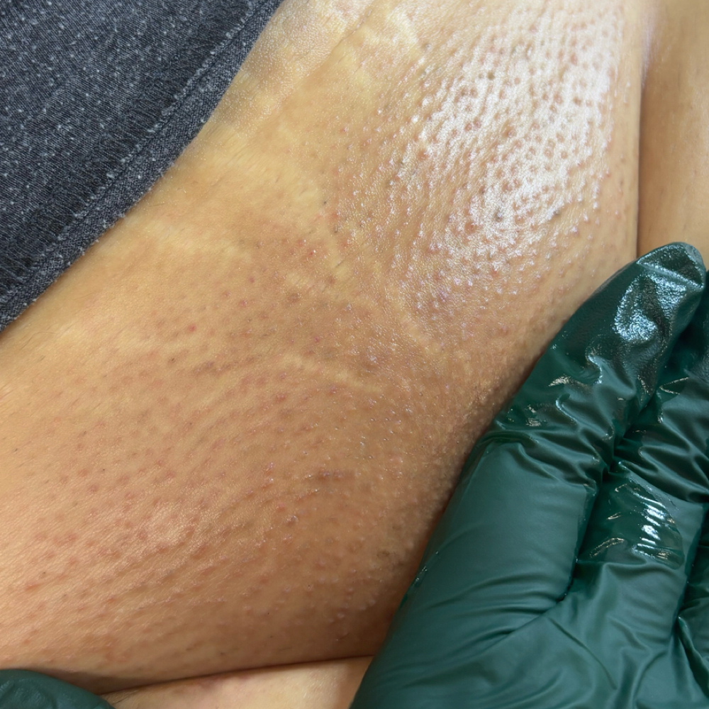 Brazilian Wax & Brow Clean Up at JSM BEAUTY ROOM in Phoenix, AZ