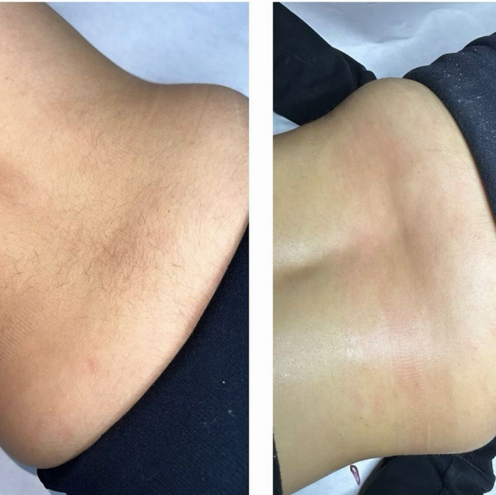 Lower Back Wax at Skin Lab by Ava Castelluzzo in Lapeer, MI