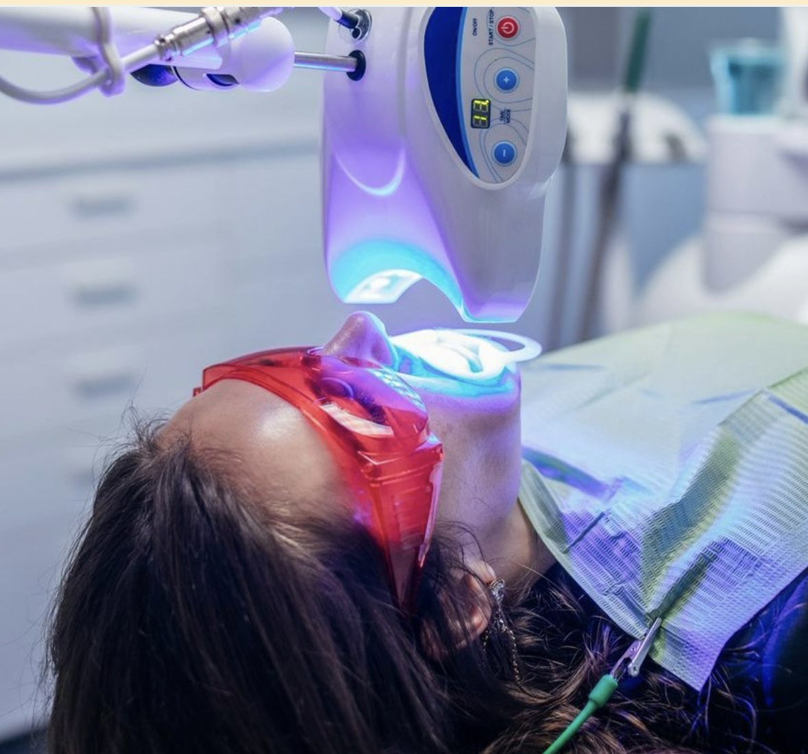 Teeth Whitening