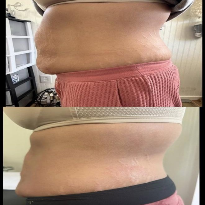 Signature Sculpt (5 Sessions) at Jay's Body Secrets in South Pittsburg, TN