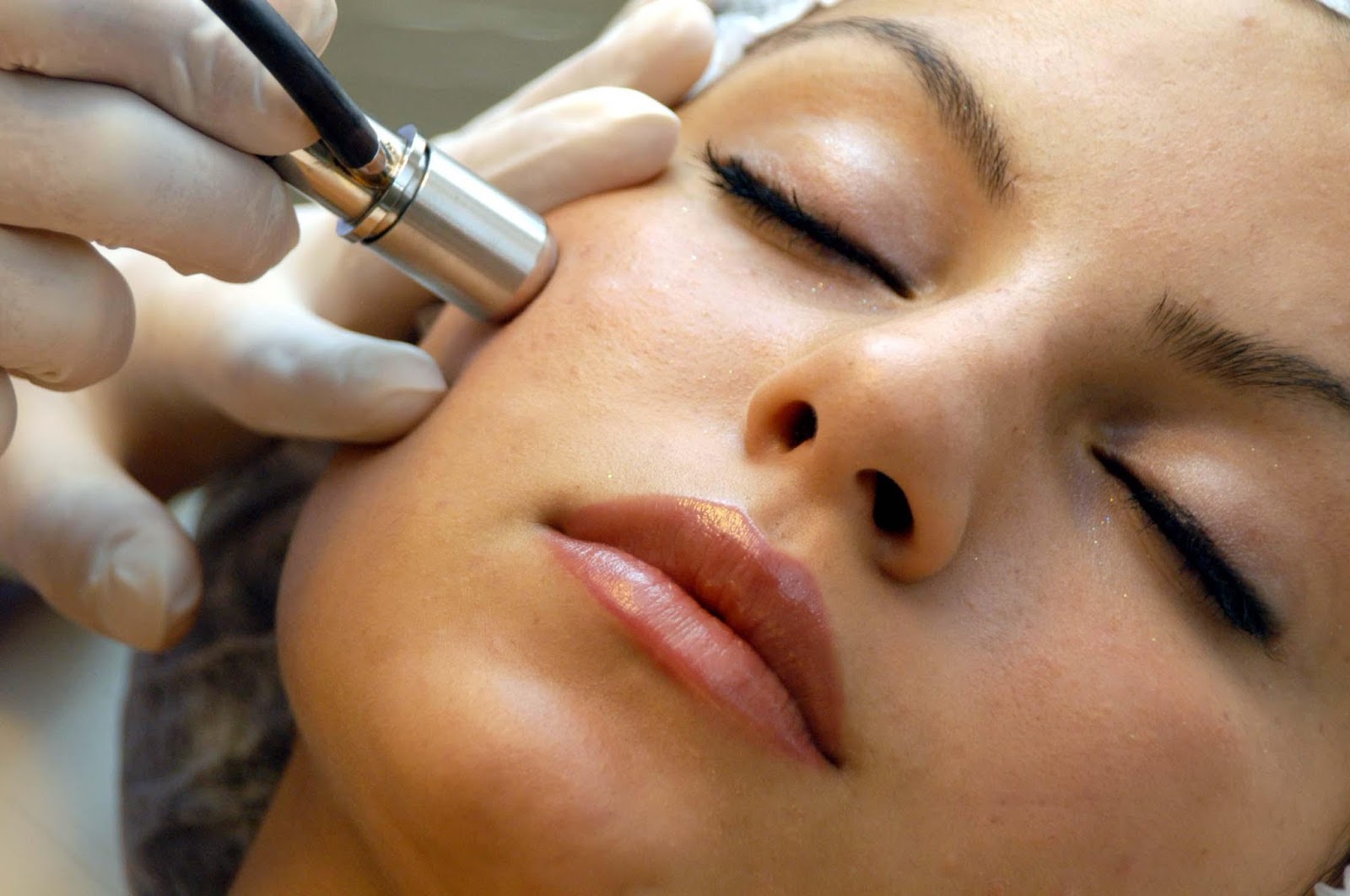 Microdermabrasion facial
