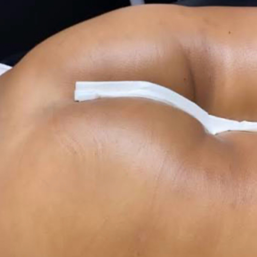 Butt Cheek Wax at Kookie Paradise in Lakewood, WA