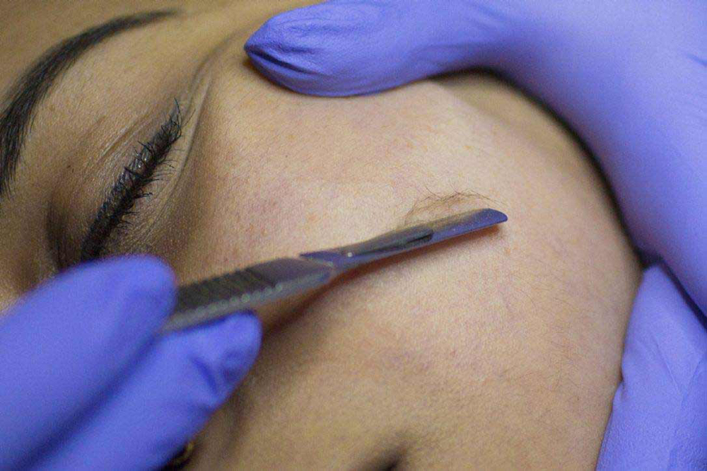 Dermaplane Facial