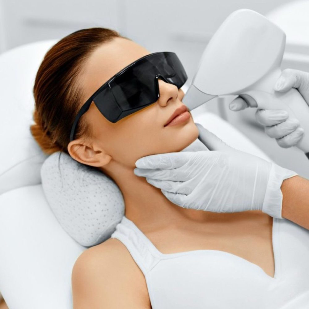 Facial Laser Hair Removal