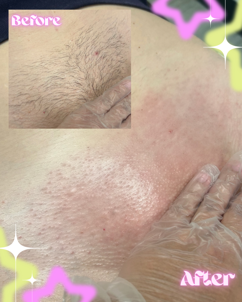 Full Brazilian at Deseo Aesthetics in Wichita, KS