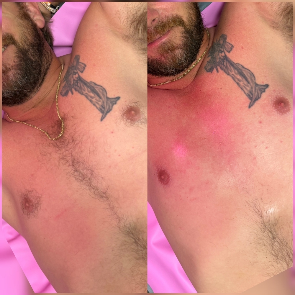Mens Chest at Beauty For All in Chalmette, LA