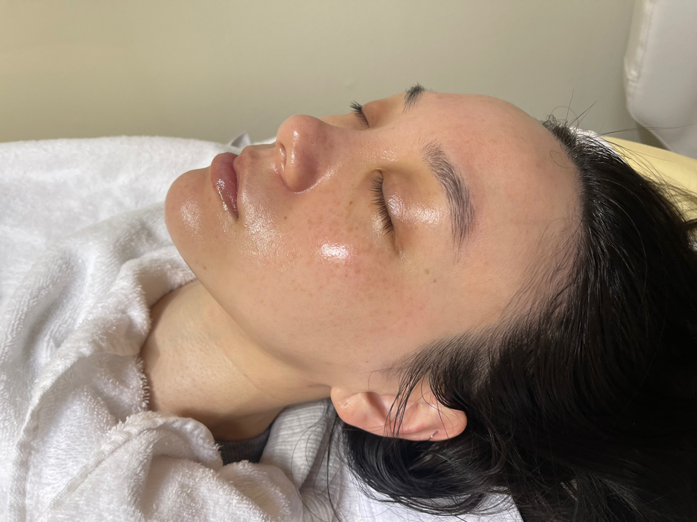 Custom Skin Treatment🧚‍♀️