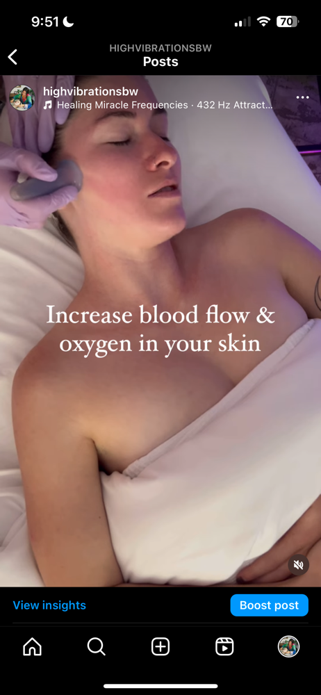 Facial Cupping