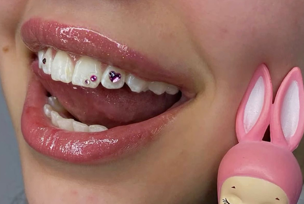 Tooth Gem Appt 💎 ( Price Varies )