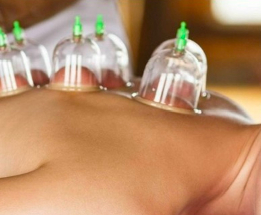 Cupping And Massage