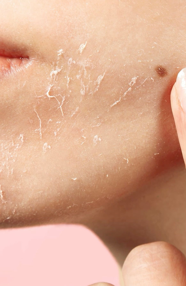 Add On Peel