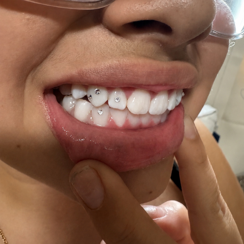 Tooth Gems at Silva Beauty Cosmetics in Santa Rosa, CA