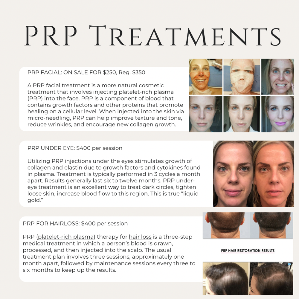 PRP Facial (Vampire Facial) at Glam By Nurse Am in Madisonville, TX
