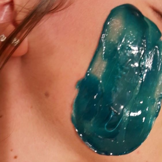 Cheeks at Sugar and Strip Esthetics in Chandler, AZ
