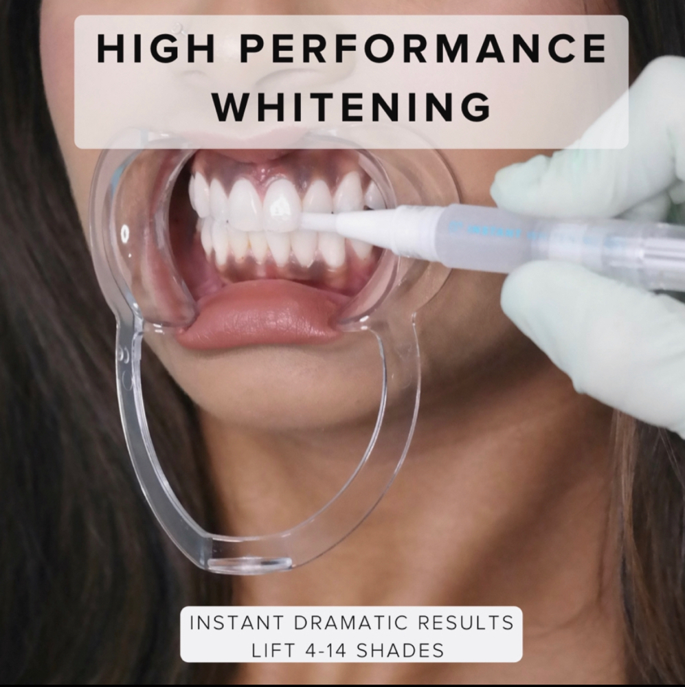 Touch Up Professional Whitening