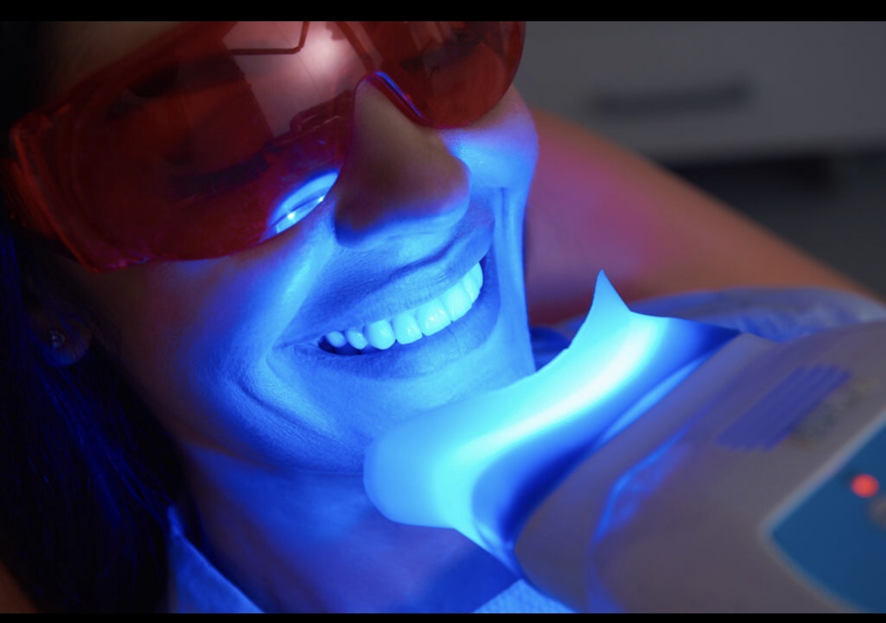 Teeth Whitening at Aurora Glow Aesthetics in Spring, TX