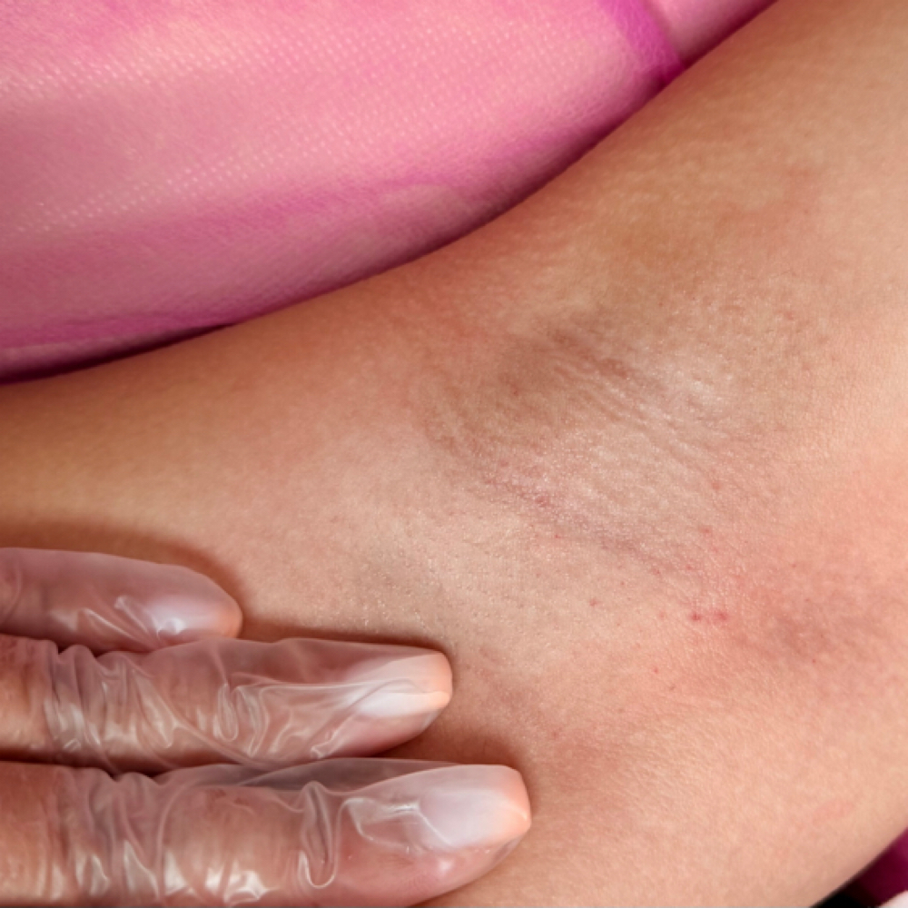 Underarm Wax at Intimate Wax Studio in Cincinnati, OH