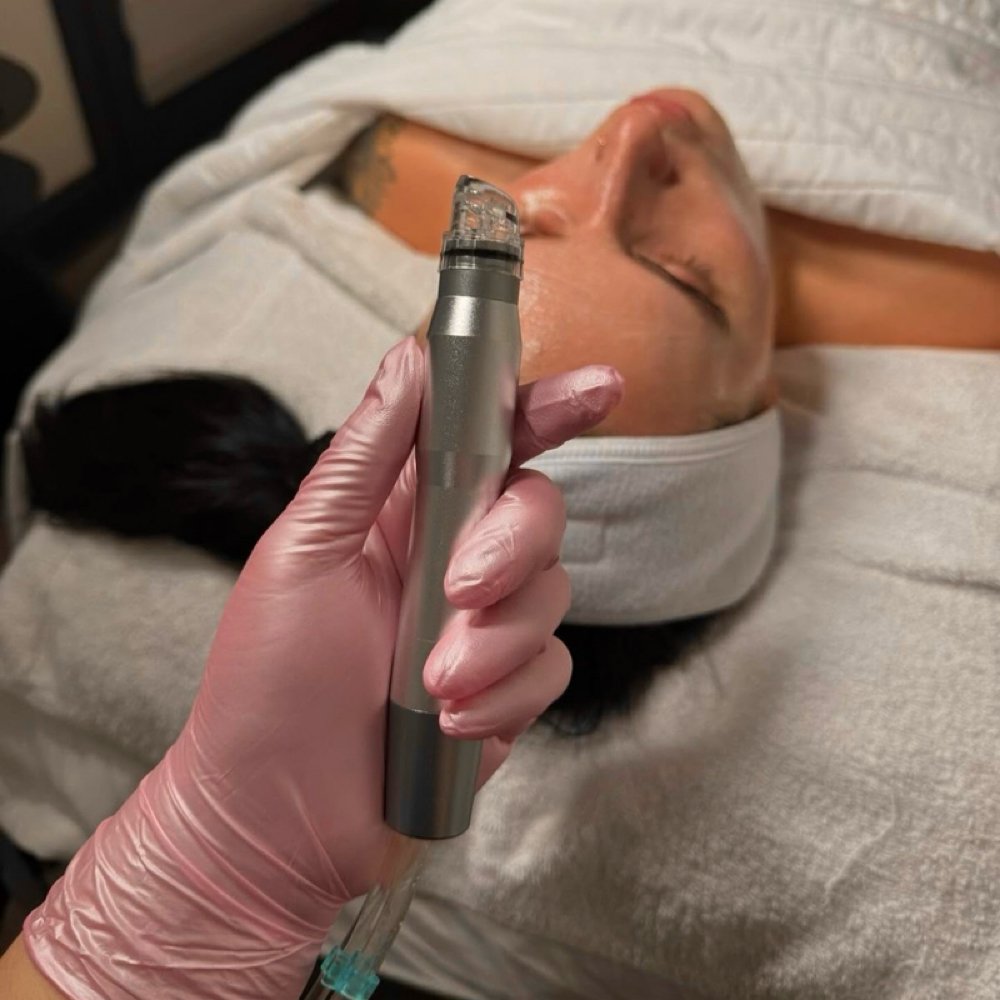 Hydrodermabrasion Facial at Studio K. in Mitchell, SD