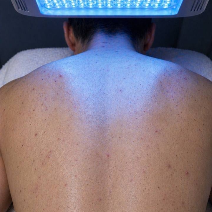 Back Facial at La VILNA in Jacksonville, FL