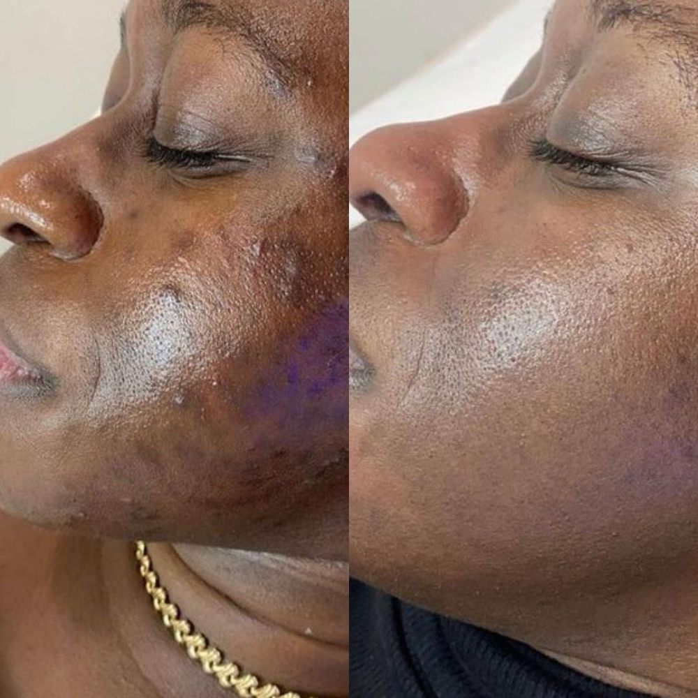 The Radiance Reset Series