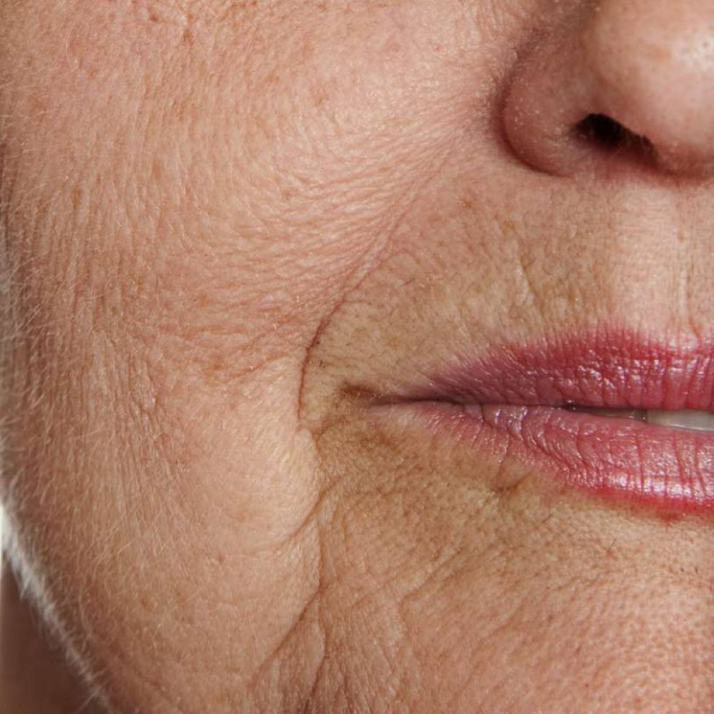 Thymeless Skin - 55+ at Tiff Thyme Esthetics