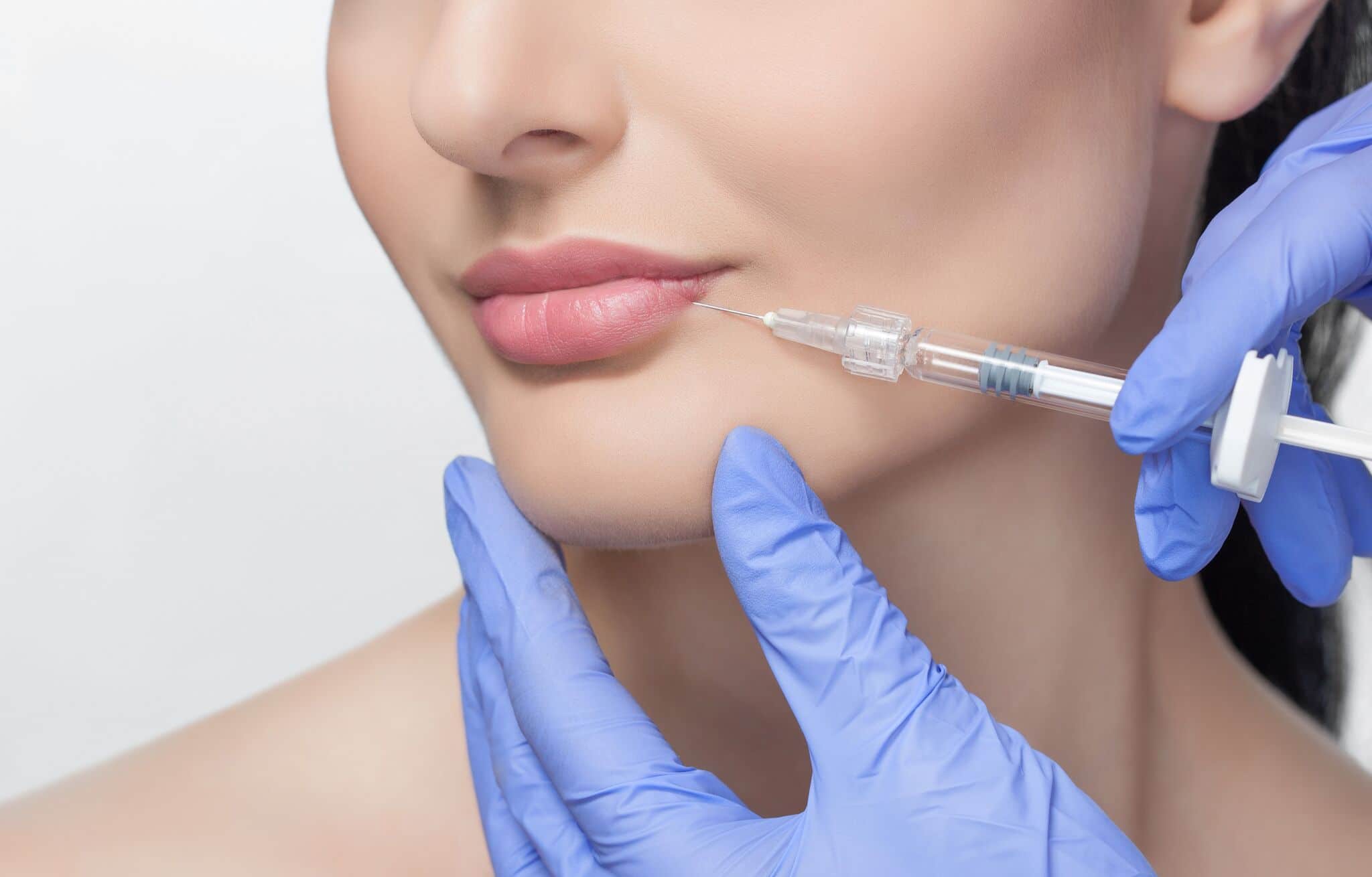 Lip augmentation