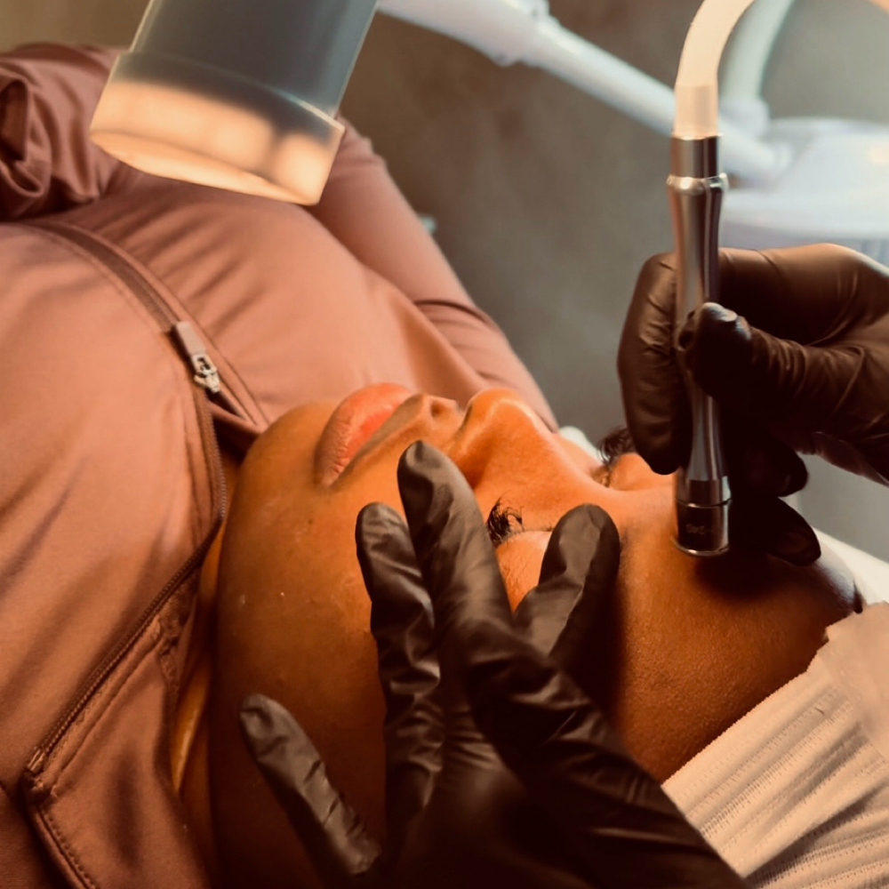 Microdermabrasion at Refinery Aesthetics Loft in Oxon Hill, MD